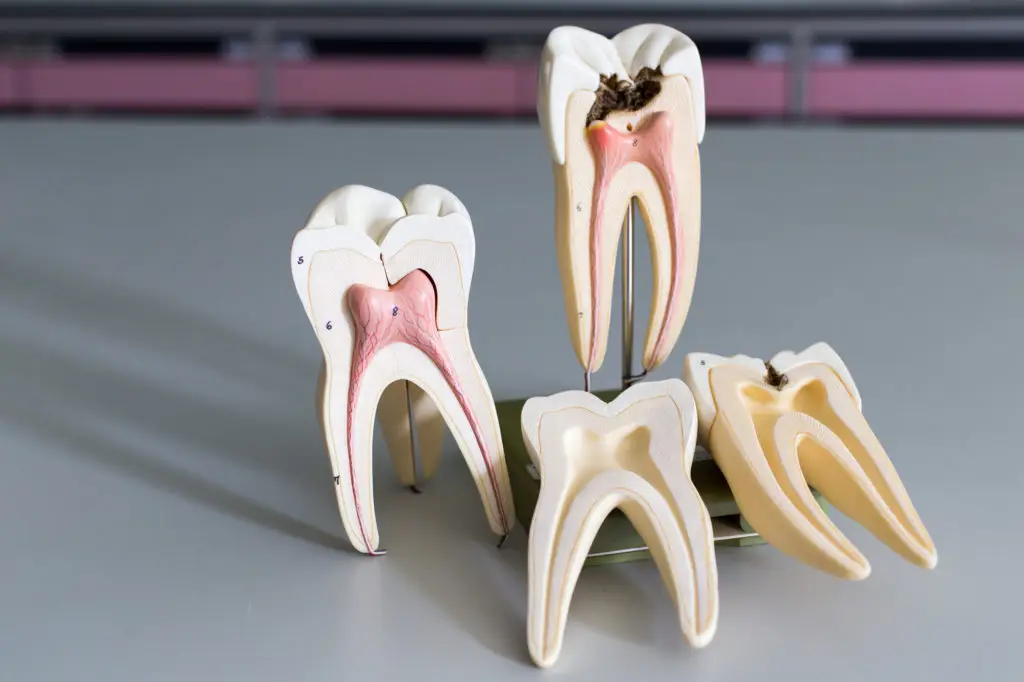 root canal recovery