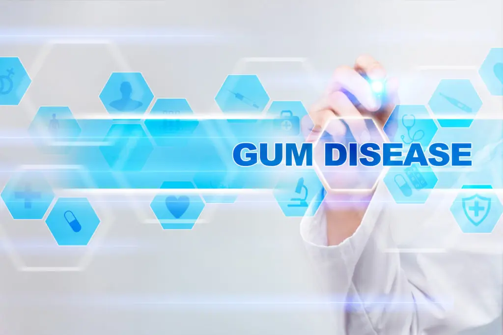 periodontal disease causes