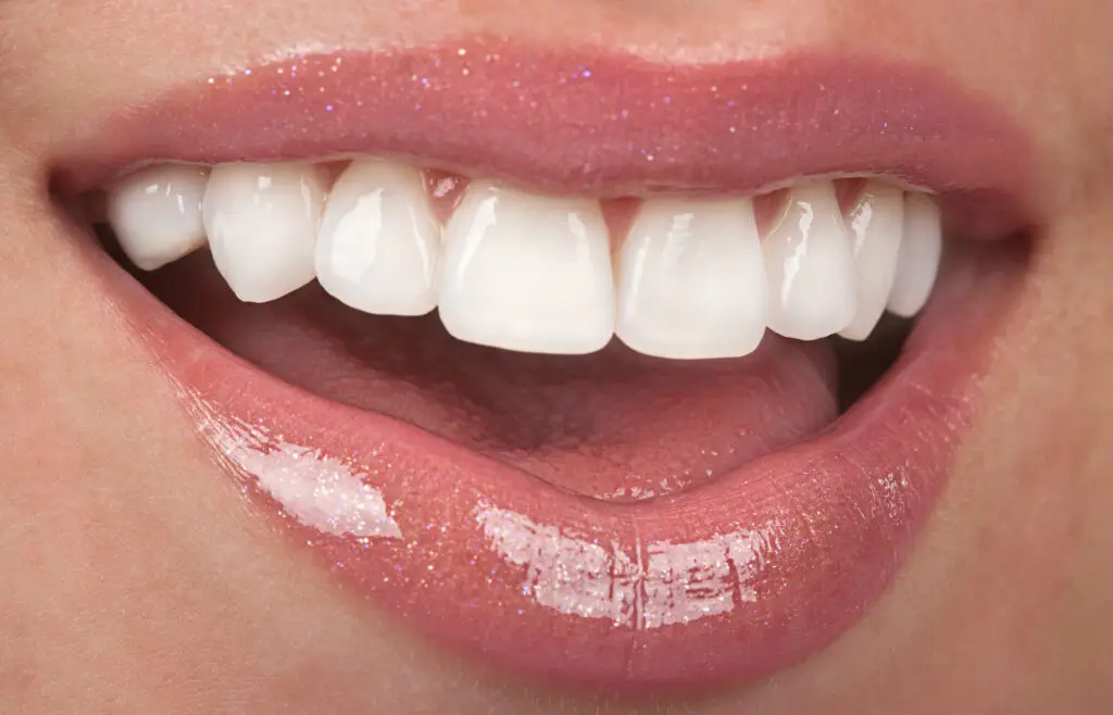 teeth whitening treatment