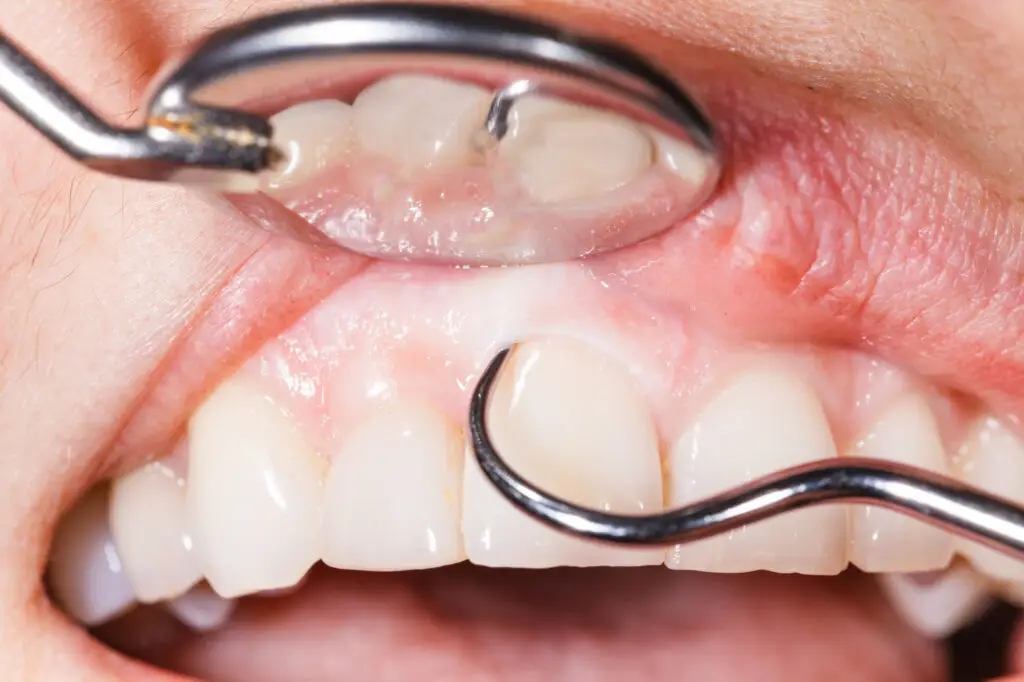 periodontist